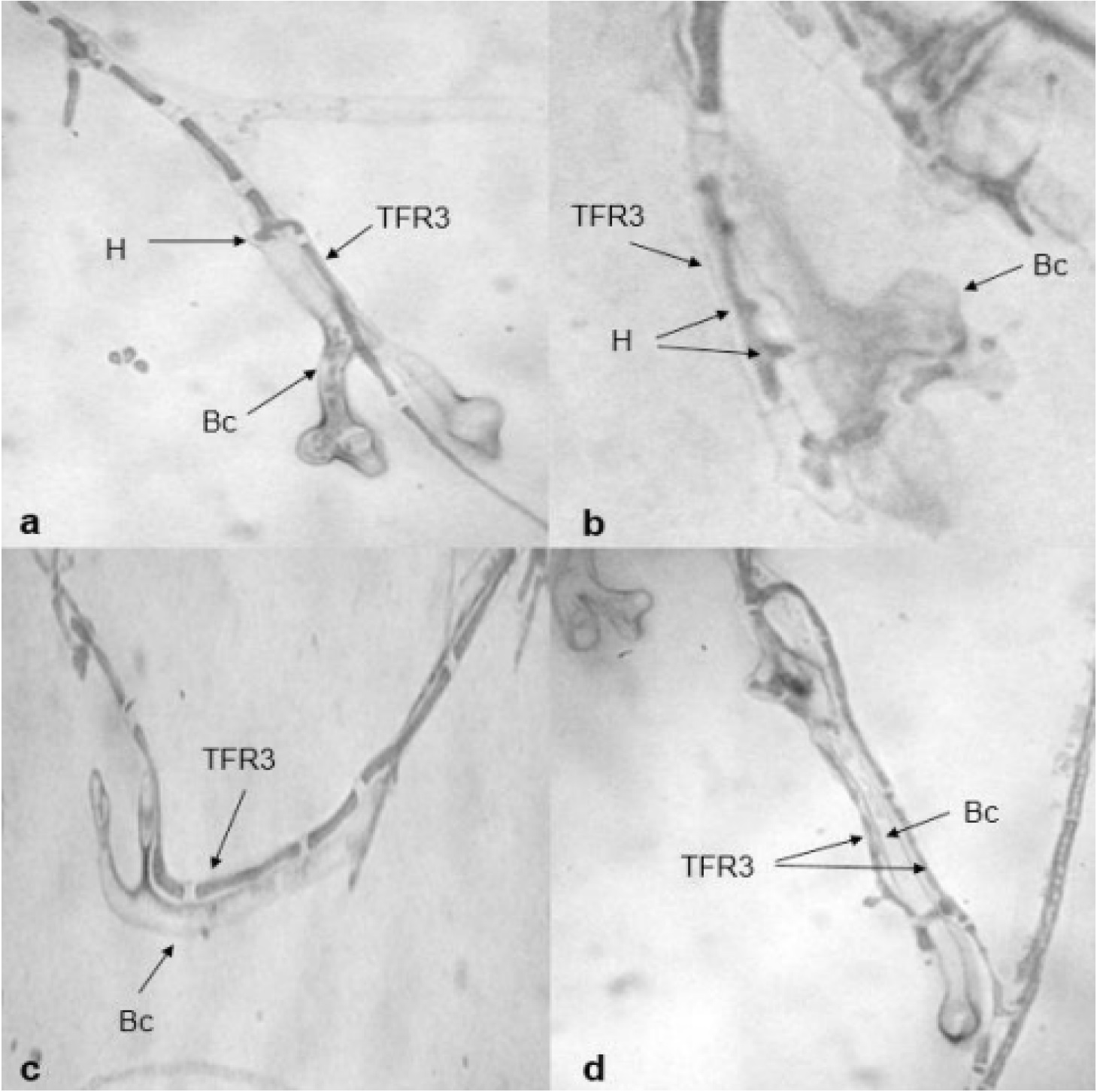 Micoparasitismo T. asperelum